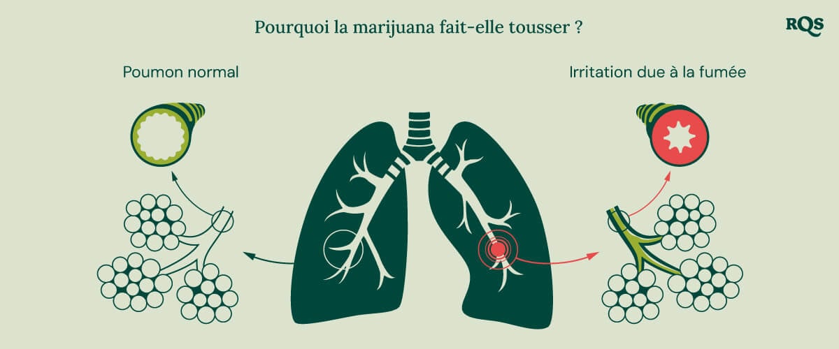 Diagramme du poumon sain vs. poumon irrité avec inflammation et gonflement des bronches causés par le cannabis.