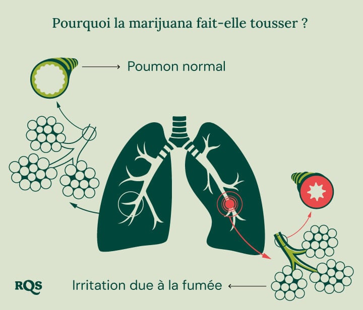 Diagramme du poumon sain vs. poumon irrité avec inflammation et gonflement des bronches causés par le cannabis.